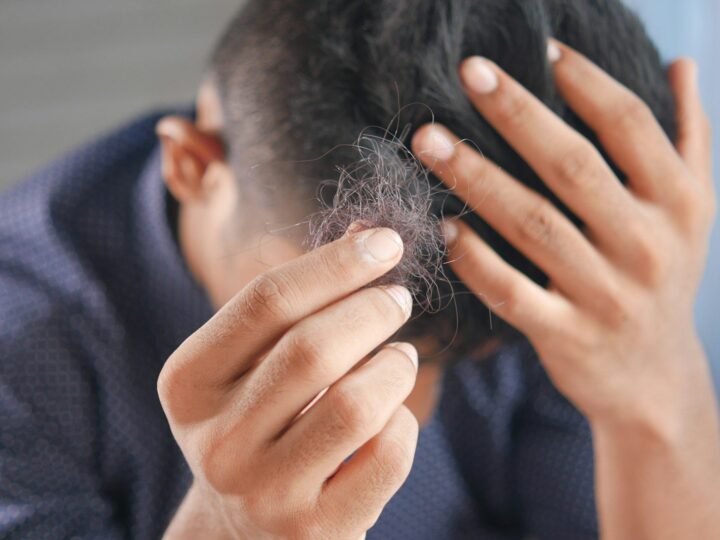 Man checking his scalp